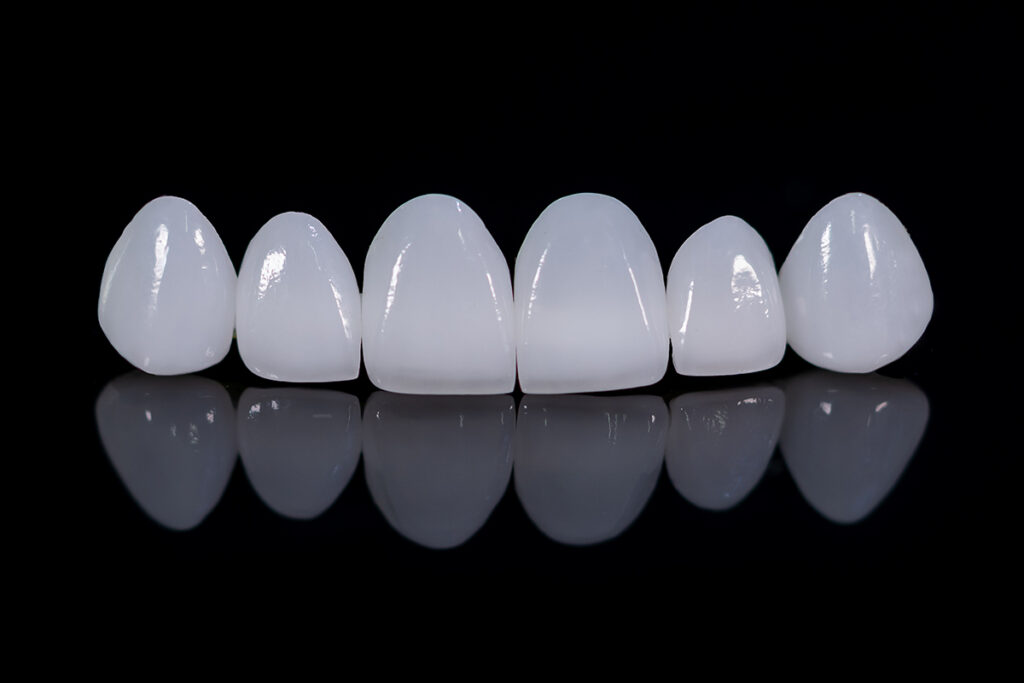 Murphy Dental Group Invisalign consultation room