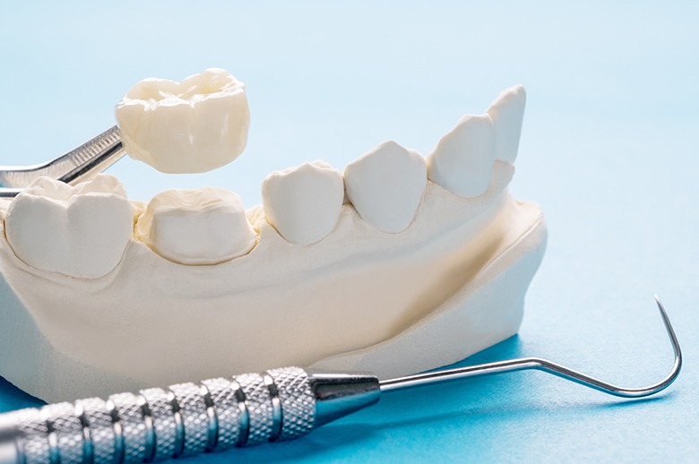 Invisalign patient discussing their results