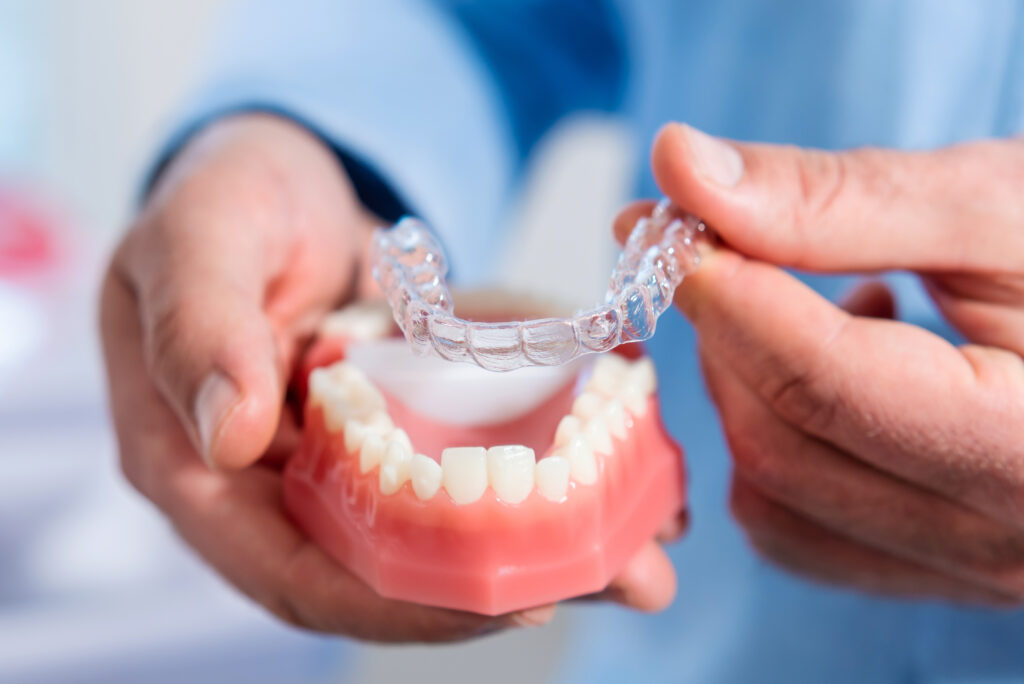 Custom Invisalign trays at Murphy Dental Group