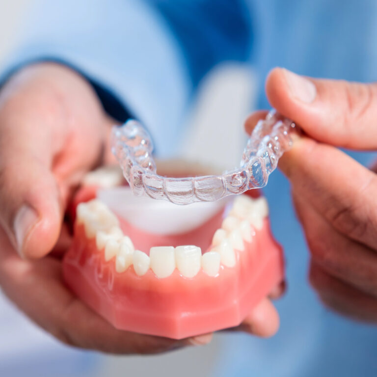 Custom Invisalign trays at Murphy Dental Group