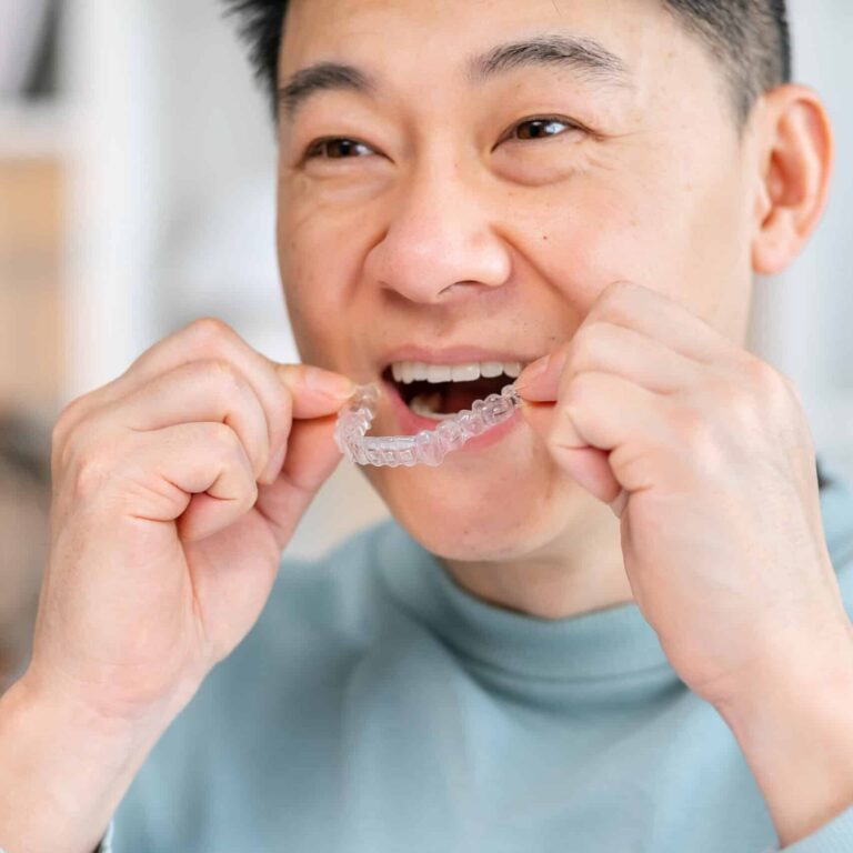 Close-up of man wearing orthodontic silicone trainer. Invisible braces aligner.