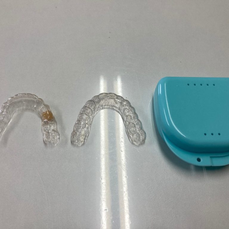 How to Prevent Stains and Discoloration During Invisalign Treatment