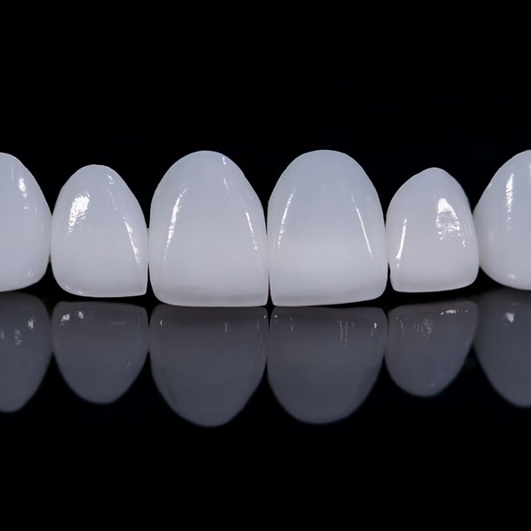 Murphy Dental Group Invisalign consultation room