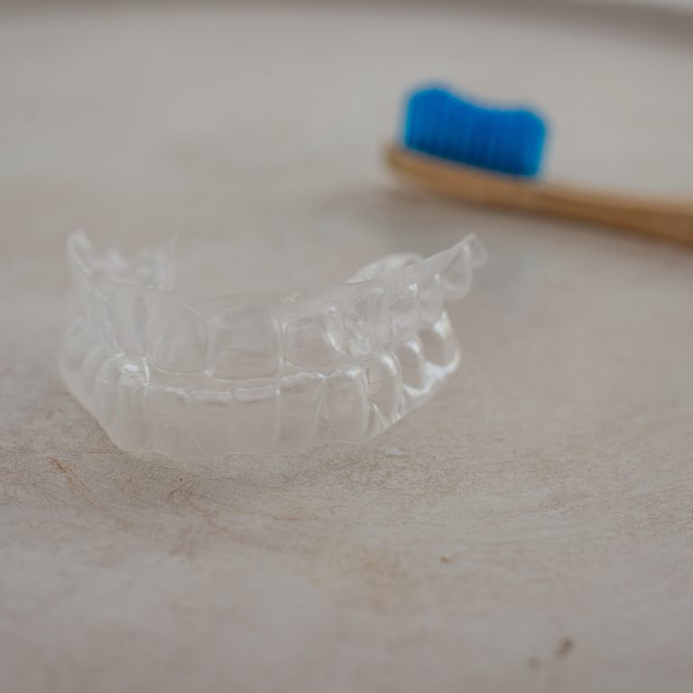What Are the Most Effective Cleaning Tips for Invisalign Aligners?