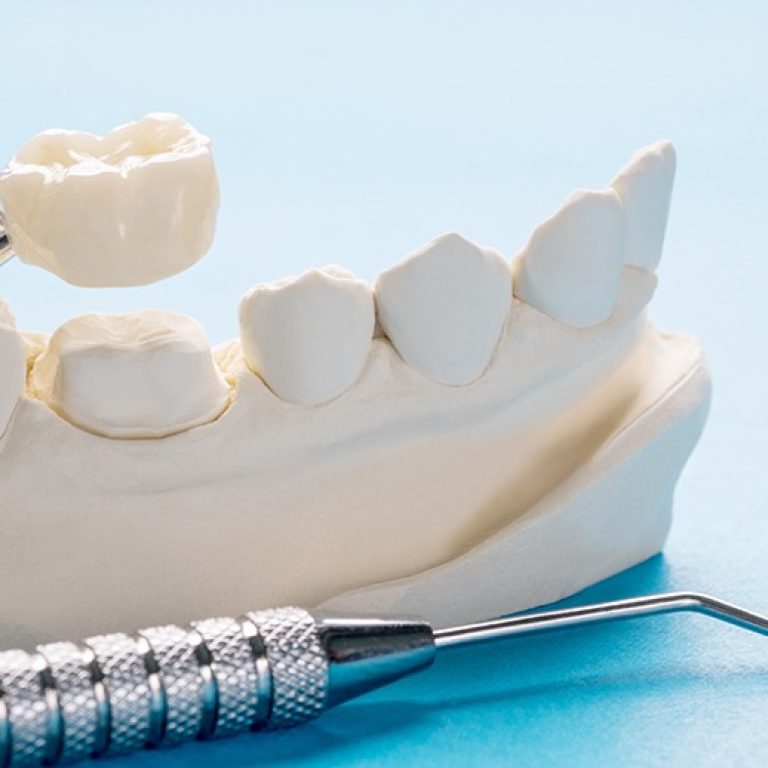 Invisalign patient discussing their results